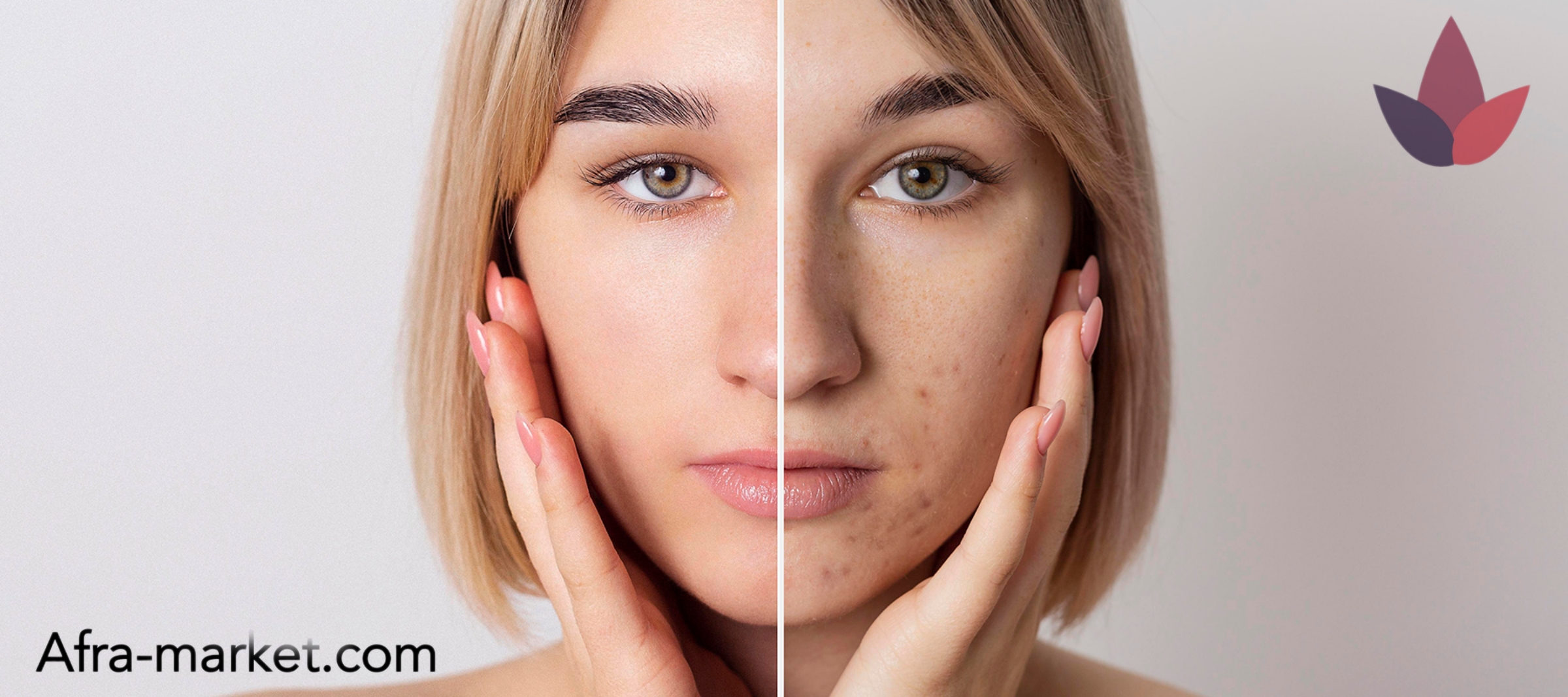 html <img src="your-image-source.jpg" alt="ترمیمکننده بعد از لیزر، موثر در بهبود سریعتر پوست و کاهش التهاب">