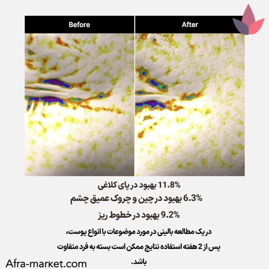 <img src="https://afra-market.com/medicube-deep-lifting-peptide-eye-cream" alt="تحقیقات علمی از عملکرد کرم دور چشم جوانساز و لیفتینگ پپتاید مدی کیوب: آزمایشات نشان دادهاند که پپتایدهای موجود در این کرم به تقویت کلاژن و الاستیسیته پوست کمک میکنند، کاهش چین و چروک و پف اطراف چشم را بهبود میبخشند و به روشنتر شدن پوست کمک میکنند، نتیجهبخش در مدت زمان کوتاه، محصول اصل برند Medicube، خرید از افرا مارکت">