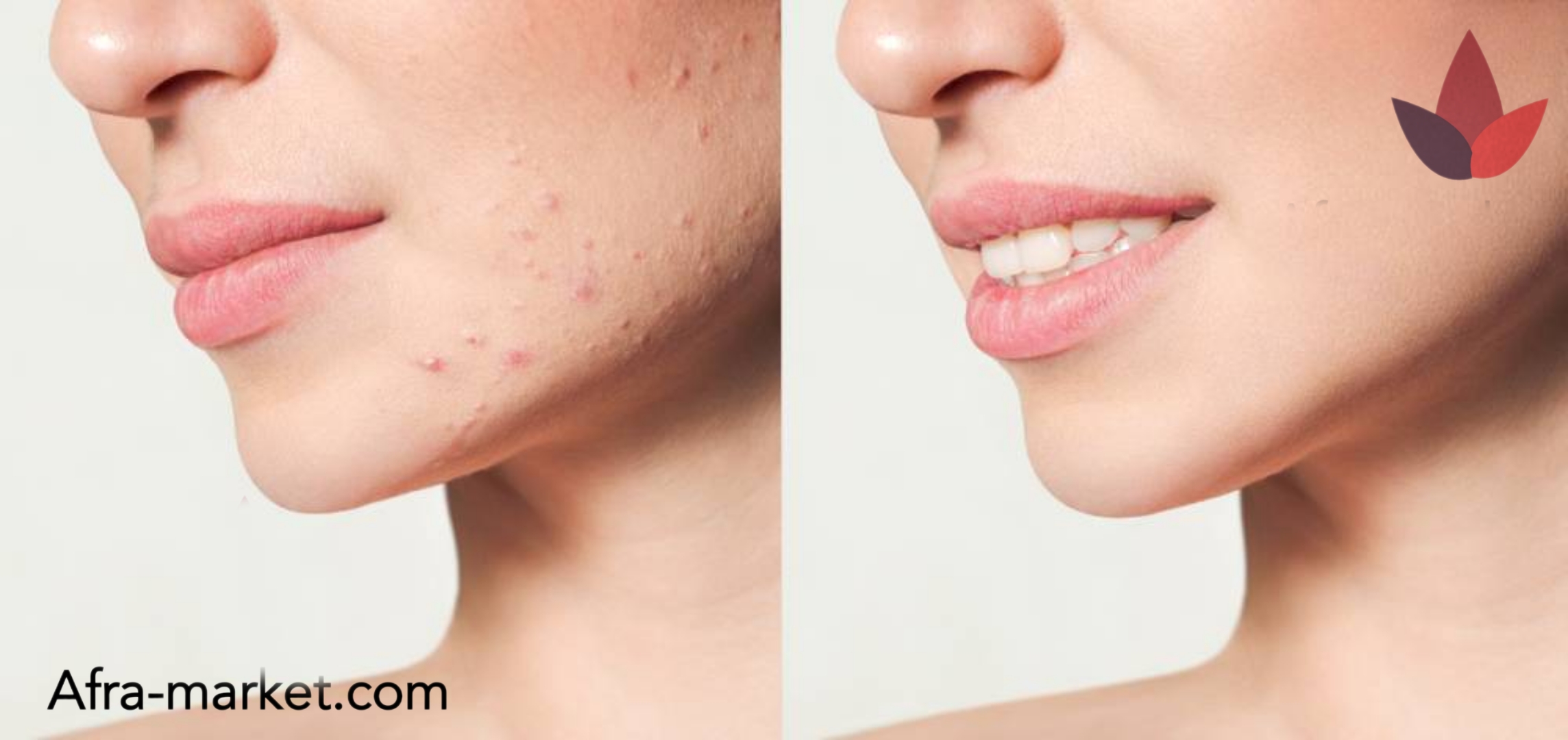 html <img src="your-image-source.jpg" alt="ترمیمکننده بعد از لیزر، با فرمولاسیونی منحصر به فرد برای بازسازی و احیای پوست آسیبدیده">