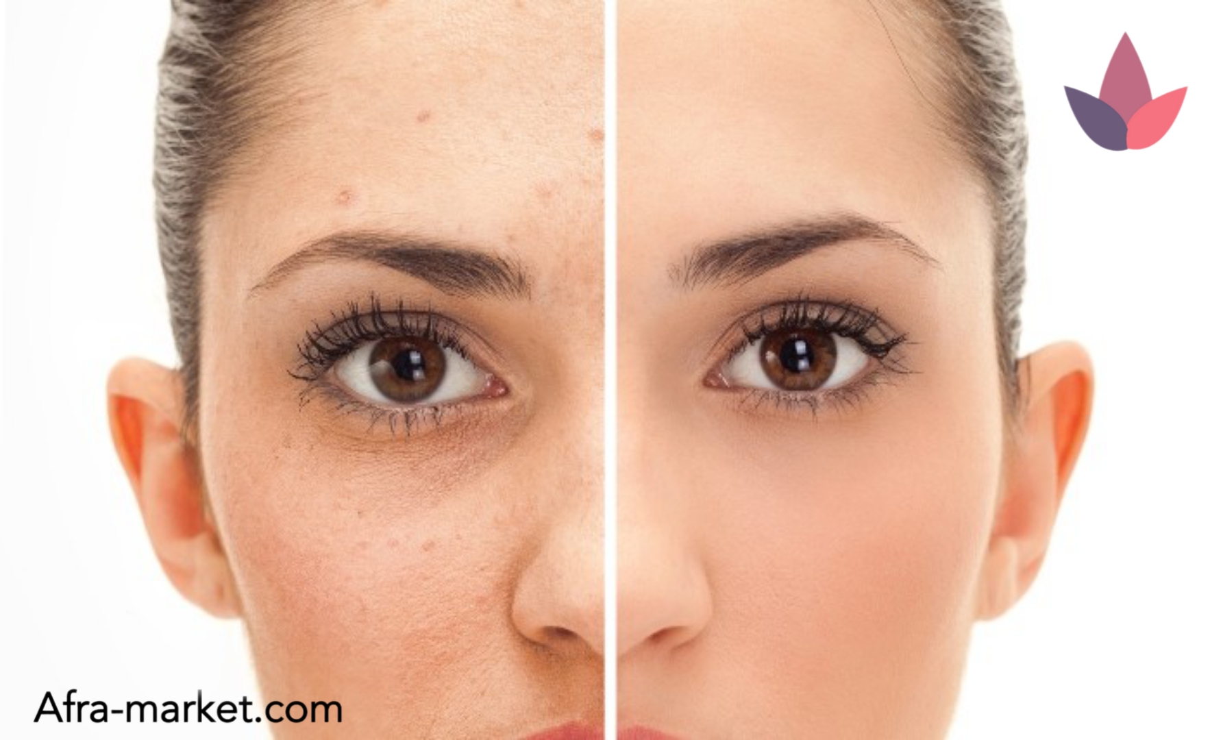 html <img src="your-image-source.jpg" alt="ترمیمکننده بعد از لیزر، حاوی ویتامینها و مواد مغذی برای پوست آسیبدیده">