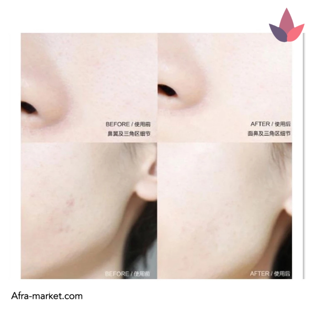 <img src="https://afra-market.com/kiehls-dark-spot-corrector-serum" alt="سرم ضد لک Kiehl's Clearly Corrective، ترمیم و بازسازی پوست، بدون ایجاد التهاب، مناسب برای کاهش تیرگی دور چشم و لک‌های مقاوم">