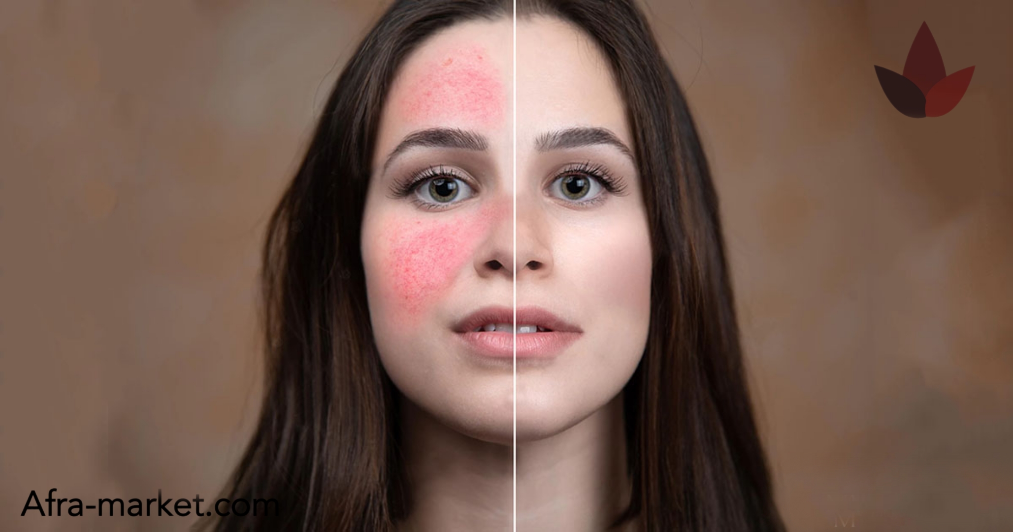 html <img src="your-image-source.jpg" alt="محصول مرطوبکننده بعد از لیزر، مناسب برای پوستهای حساس و آسیبدیده">