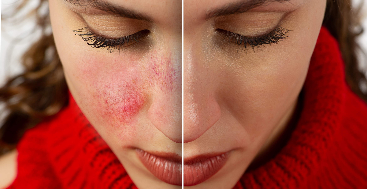 html <img src="your-image-source.jpg" alt="محصول ترمیمکننده بعد از لیزر، مناسب برای تسریع فرآیند بهبود پوست">