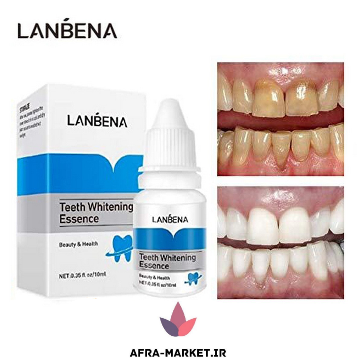 سفیدکننده دندان لانبنا: راهی مؤثر برای داشتن لبخند درخشان و زیبا