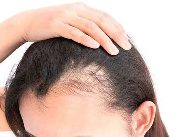 ۵ روش طبیعی برای رشد مجدد موهای ریخته