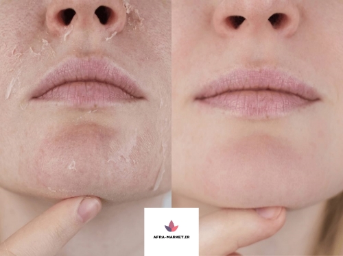 ترفندهایی برای تشخیص اینکه پوست چرب است یا خشک