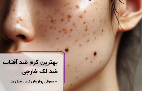 ۵ ضد آفتاب و ضد لک برتر برای حفظ سلامت و زیبایی پوست