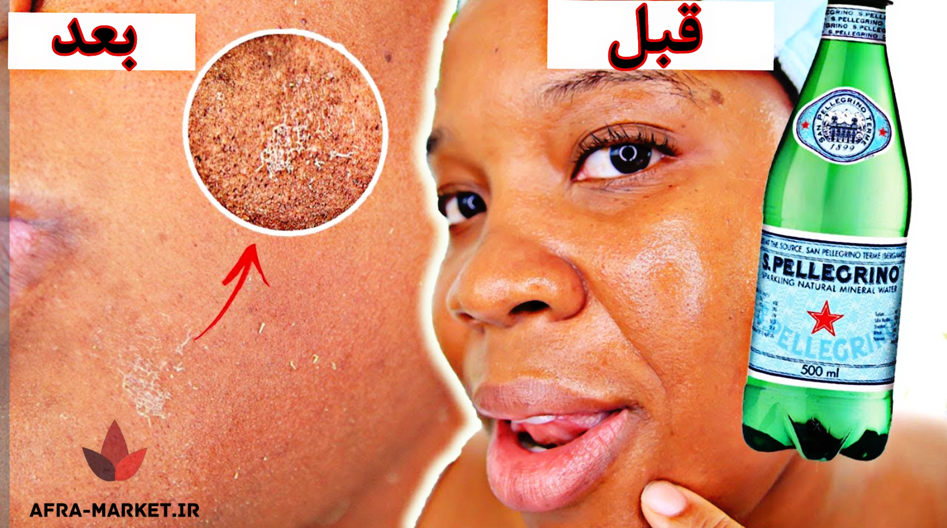 شستن صورت با آب گاز دار | درخشان کردن صورت با آب گاز دار