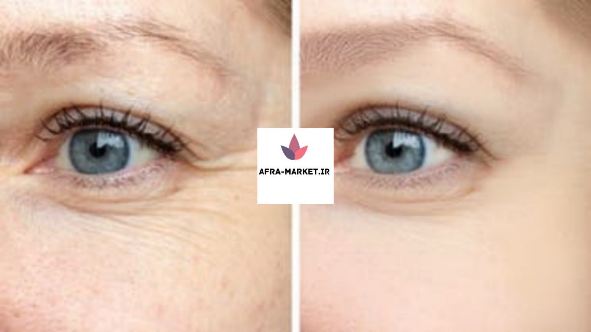 8 ماده خوراکی که زنان را جوان‌تر می‌کند