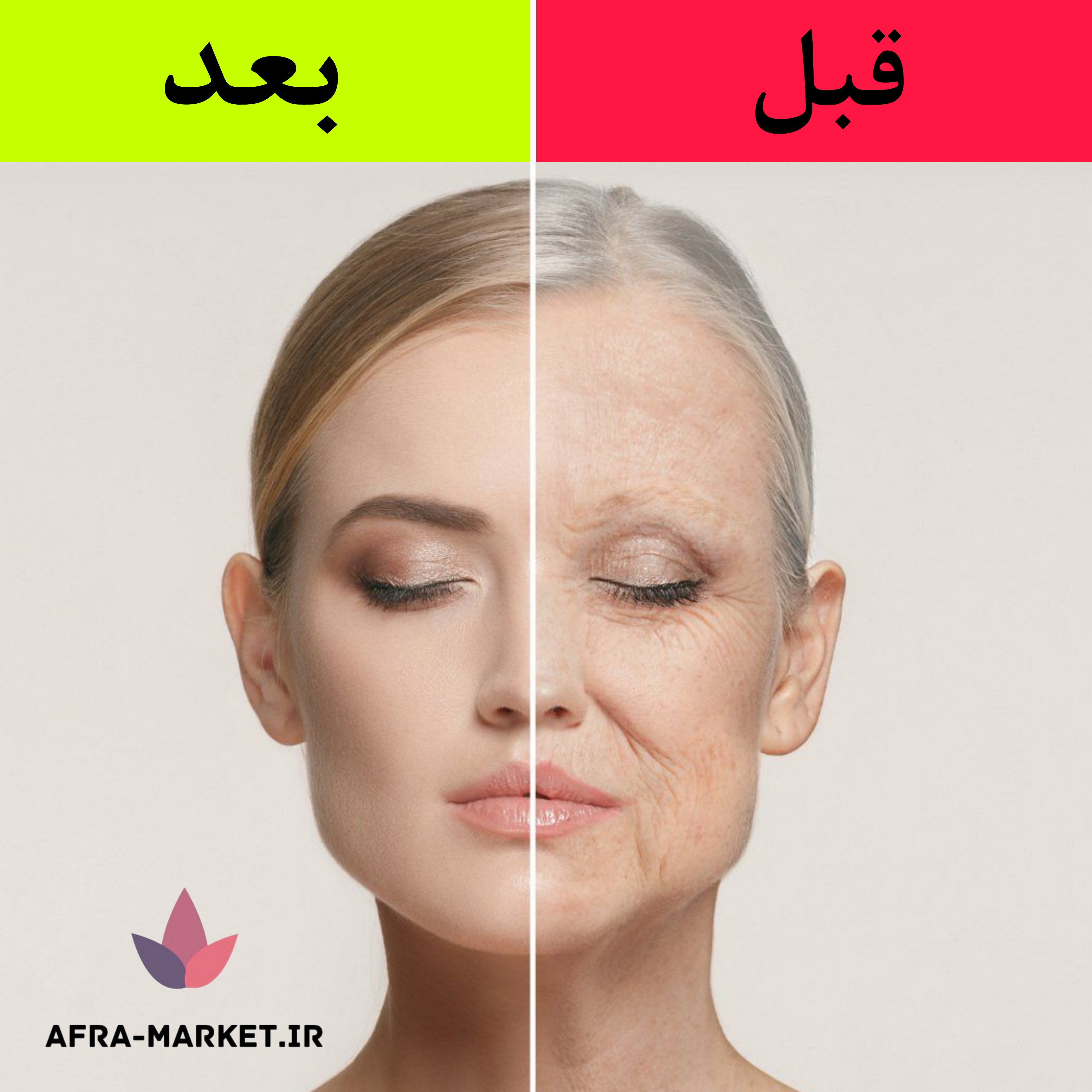 از بین بردن چین و چروک در یک هفته