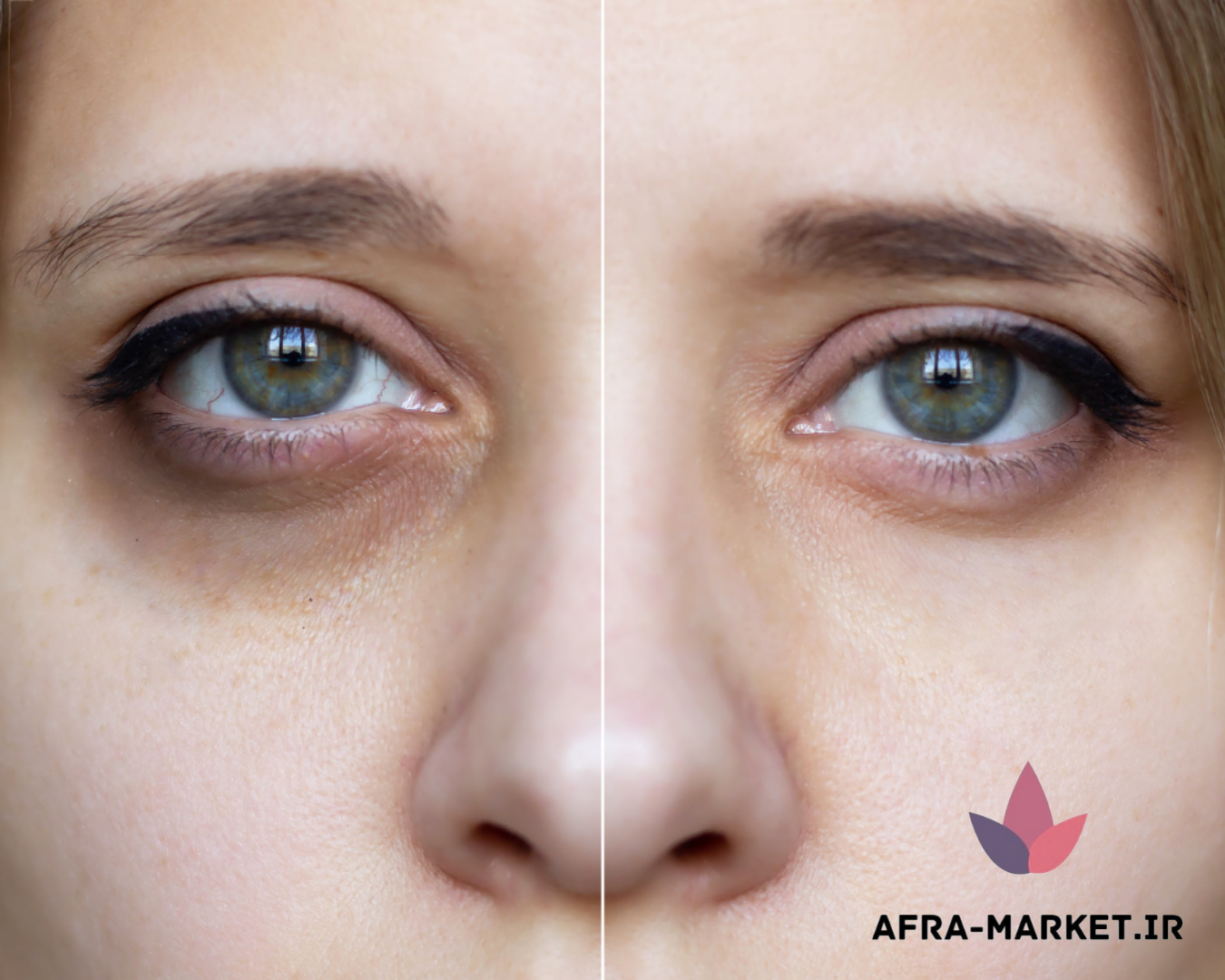 چگونه از کانتور چشم خود بهتر مراقبت کنیم.