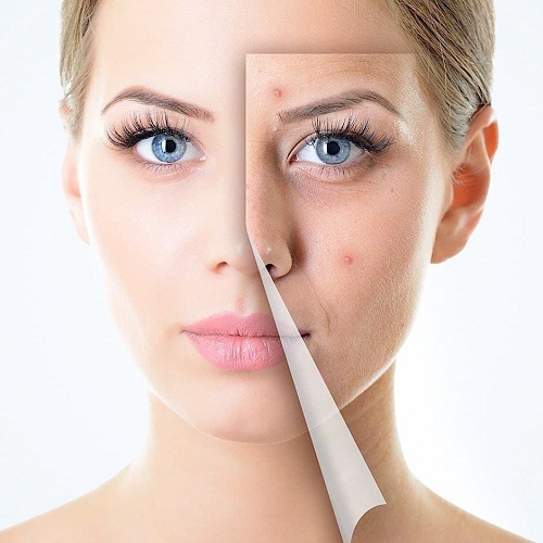 داشتن پوستی شاداب و جوان با محصولات آرایشی و بهداشتی اصل اورجینال افرا مارکت